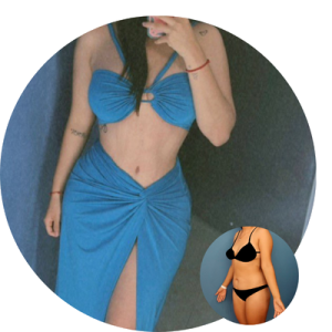 R. B. Testimonio Mommy Makeover