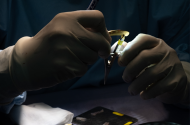 Cirugía Plástica de Nariz