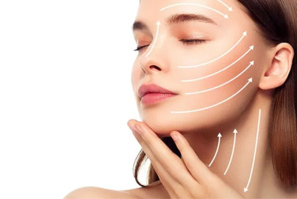 Rinoplastia con resultados naturales en Mérida
