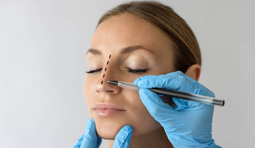 Rinoplastia cambia rostro al mejorar armonía facial