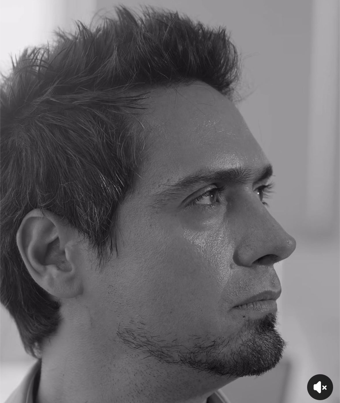 Rinoplastia para hombres