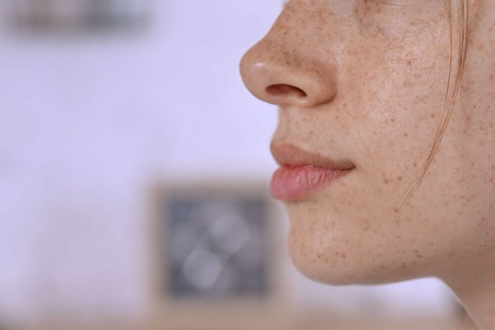 Cambio de rostro por rinoplastia