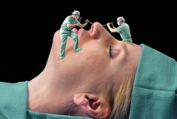 Anestesia rinoplastia asegura seguridad quirúrgica