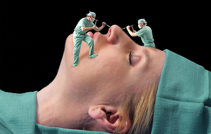 Anestesia rinoplastia asegura seguridad quirúrgica