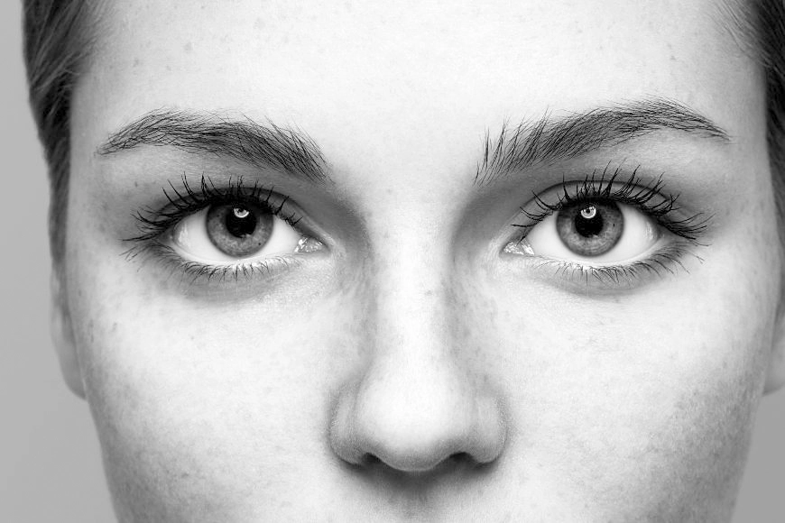 Pacientes reciben recomendaciones clave antes durante y después de la rinoplastia