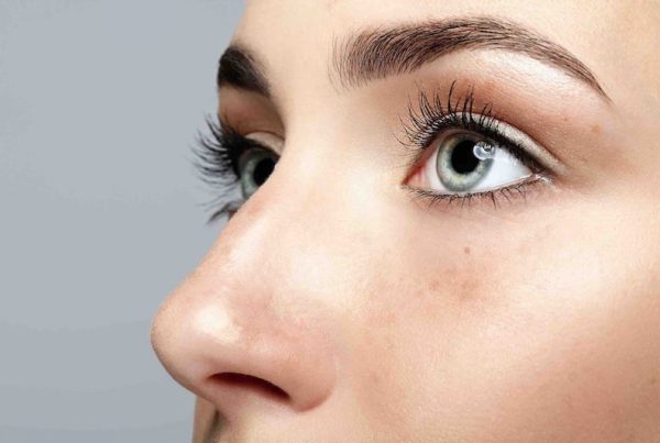 Diferencias entre rinomodelación y rinoplastia
