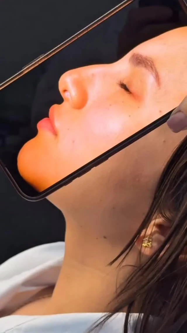 𝗥𝗣𝗗 – 𝗥ENACE TU 𝗣ERFIL 𝗗EFINITIVO 
✨🌷Redescubre tu esencia con una nariz que refleje quién eres.
La rinoplastia ultrasónica con secuencia RPD transforma con precisión y sutileza, devolviéndote confianza desde el primer reflejo.

𝗥𝗶𝗻𝗼𝗽𝗹𝗮𝘀𝘁𝗶𝗮 𝗨𝗹𝘁𝗿𝗮𝘀𝗼́𝗻𝗶𝗰𝗮 𝗰𝗼𝗻 𝘀𝗲𝗰𝘂𝗲𝗻𝗰𝗶𝗮 𝗥𝗣𝗗
✅𝗔𝗴𝗲𝗻𝗱𝗮 𝘁𝘂 𝗰𝗶𝘁𝗮 𝗵𝗼𝘆 𝗺𝗶𝘀𝗺𝗼
Dirígete al siguiente Link 👇🏻
Paso 1._ Realiza la valoración Online.
https://doctorfajardo.com/valoraciones-online/
paso 2._Obtén tu consulta personal gratuita
paso 3._Obtén tu cotización y agenda tu cirugía.
Ubicamos en el Hospital Star Médica 🏥
Consultorio 723 
C. 26 199, Col. Altabrisa, 97130 Mérida, Yuc. 📍
📱 Contáctanos: 9992 45 73 83 Ver menos