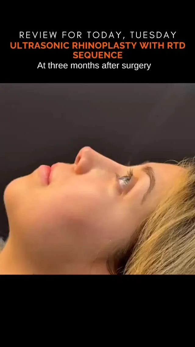 𝗥𝗣𝗗 – 𝗥ENACE TU 𝗣ERFIL 𝗗EFINITIVO 
✨🌷Redescubre tu esencia con una nariz que refleje quién eres.
La rinoplastia ultrasónica con secuencia RPD transforma con precisión y sutileza, devolviéndote confianza desde el primer reflejo.

𝗥𝗶𝗻𝗼𝗽𝗹𝗮𝘀𝘁𝗶𝗮 𝗨𝗹𝘁𝗿𝗮𝘀𝗼́𝗻𝗶𝗰𝗮 𝗰𝗼𝗻 𝘀𝗲𝗰𝘂𝗲𝗻𝗰𝗶𝗮 𝗥𝗣𝗗
✅𝗔𝗴𝗲𝗻𝗱𝗮 𝘁𝘂 𝗰𝗶𝘁𝗮 𝗵𝗼𝘆 𝗺𝗶𝘀𝗺𝗼
Dirígete al siguiente Link 👇🏻
Paso 1._ Realiza la valoración Online.
https://doctorfajardo.com/valoraciones-online/
paso 2._Obtén tu consulta personal gratuita
paso 3._Obtén tu cotización y agenda tu cirugía.
Ubicamos en el Hospital Star Médica 🏥
Consultorio 723 
C. 26 199, Col. Altabrisa, 97130 Mérida, Yuc. 📍
📱 Contáctanos: 9992 45 73 83 Ver menos