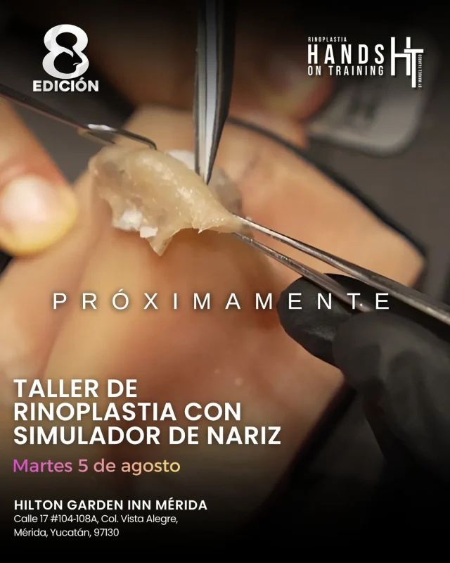 Nos complace anunciar que próximamente se llevará a cabo la 8ª edición del Hands On Training Rinoplastia. By Dr. Manuel fajardo Lara. Próximamente tendremos nuestro  Taller de Rinoplastia con Simulador de Nariz, K- NOSE®️ una experiencia de entrenamiento práctico intensivo.

📅 Fecha: Martes 5 de agosto
📍 Sede: Hilton Garden Inn Mérida
Calle 17 #104-108A, Col. Vista Alegre, Mérida, Yucatán, 97130

Organizado por Rinoplastia Hands On Training Rinoplastia ®️, este taller está dirigido a cirujanos plásticos certificados que buscan perfeccionar sus técnicas en rinoplastia mediante simuladores especializados.

@rinoplastia.fellow @dr.kochol.rinoplastia 
@handsontrainingrhinoplasty